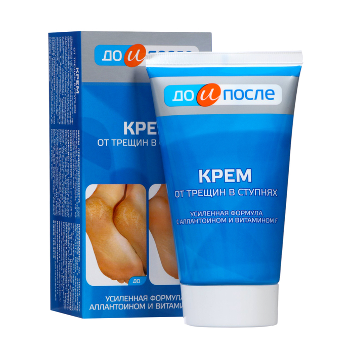 Крем для ног «До и После» от трещин в ступнях, 150 мл