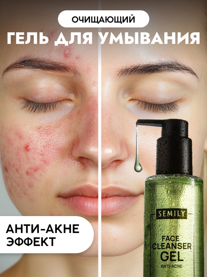 Гель для умывания для проблемной кожи SEMILY против акне, очищающий, 200 мл