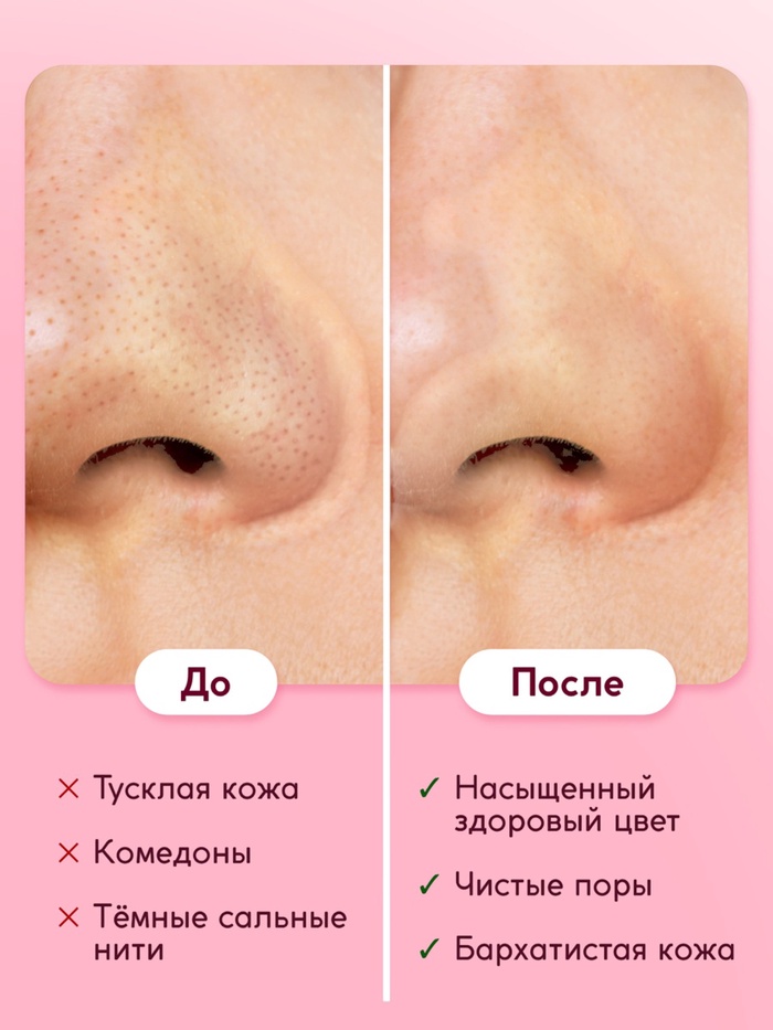 Пилинг-скатка для лица SEMILY с фруктовыми кислотами, мягкое отшелушивание, 75 мл