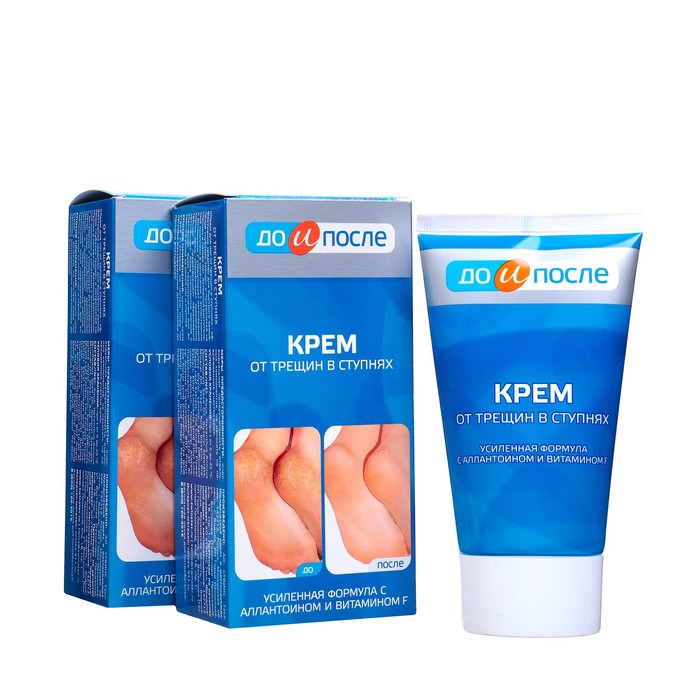 Крем для ног «До и После» от трещин в ступнях, 2 шт. по 150 мл