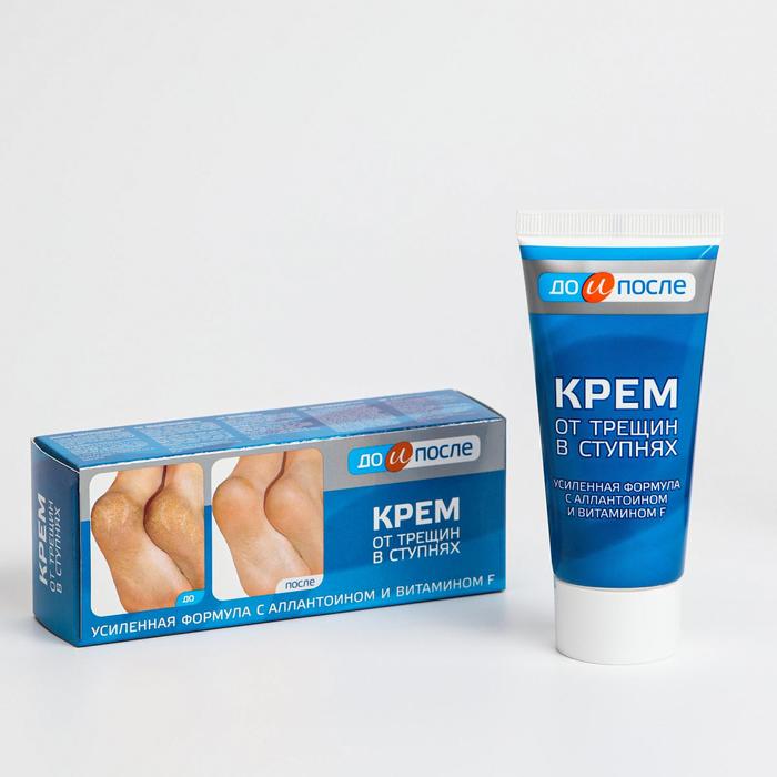 Крем для ног от трещин в ступнях, «До и После», 50 мл